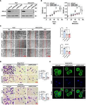 Corrigendum: Ribosomal protein L23 drives the metastasis of hepatocellular carcinoma via upregulating MMP9